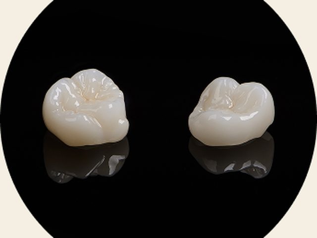 Estética dental