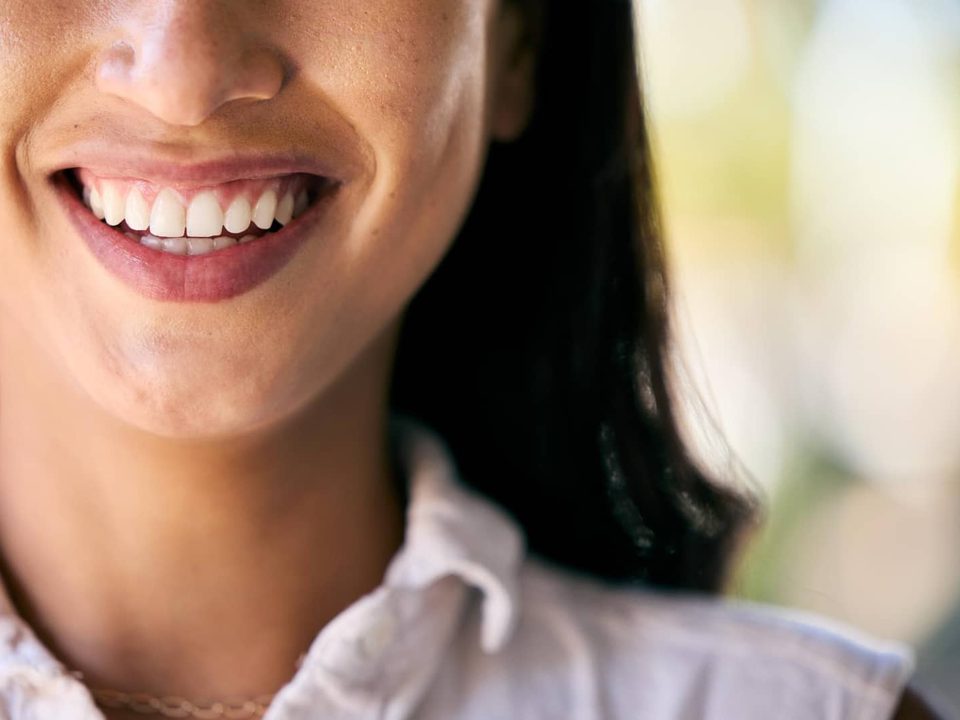 Sonrisa tras un tratamiento de carillas dentales