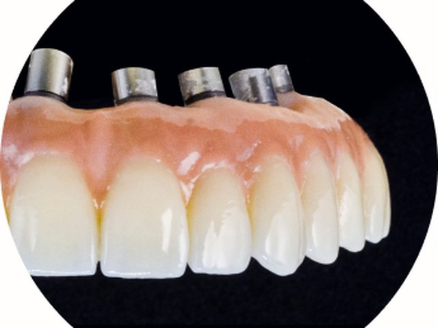 Odontología holística